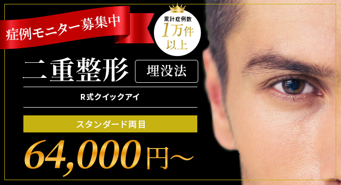 症例モニター募集中　二重整形 埋没法R式クイックイ　スタンダード両目￥64,000～