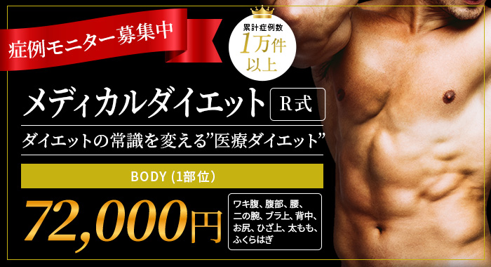 症例モニター募集中　メディカルダイエットR式　ダイエットの常識を変える”医療ダイエット”　BODY (1部位）￥72,000　ワキ腹、腹部、、腰、二の腕、ブラ上、背中、お尻、ひざ上、太もも、ふくらはぎ