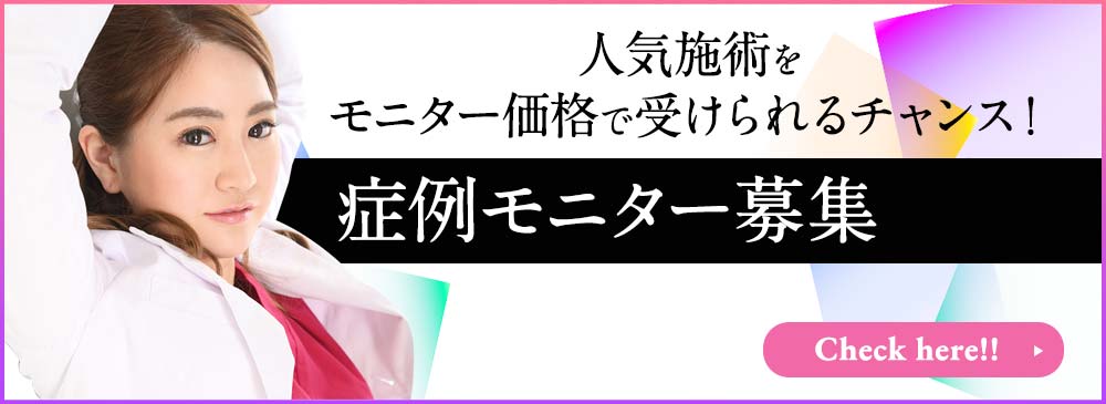 モニター募集