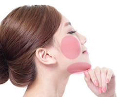 ホホアゴ下脂肪吸引