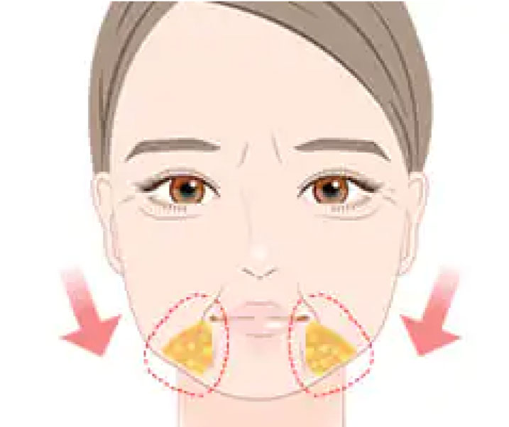 ジョールファット