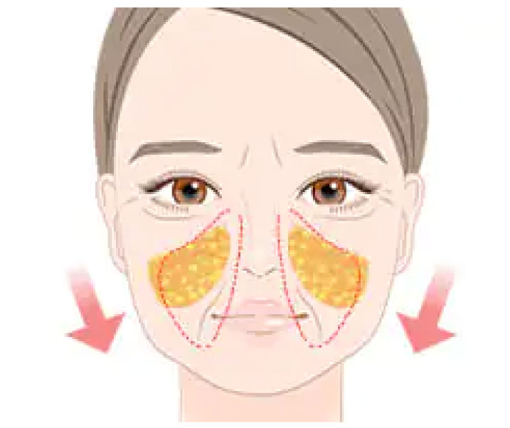 メーラーファット